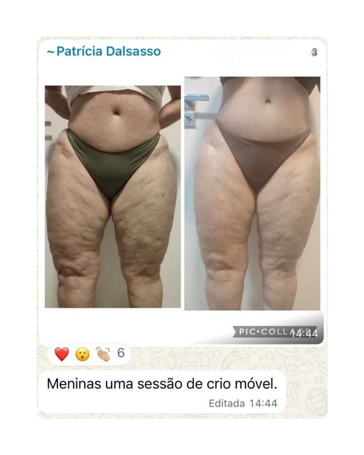Depoimento de paciente