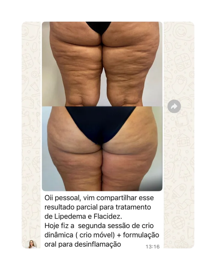 Depoimento de paciente