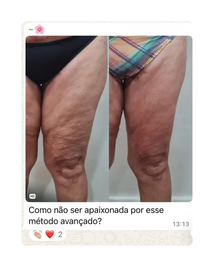 Depoimento de paciente