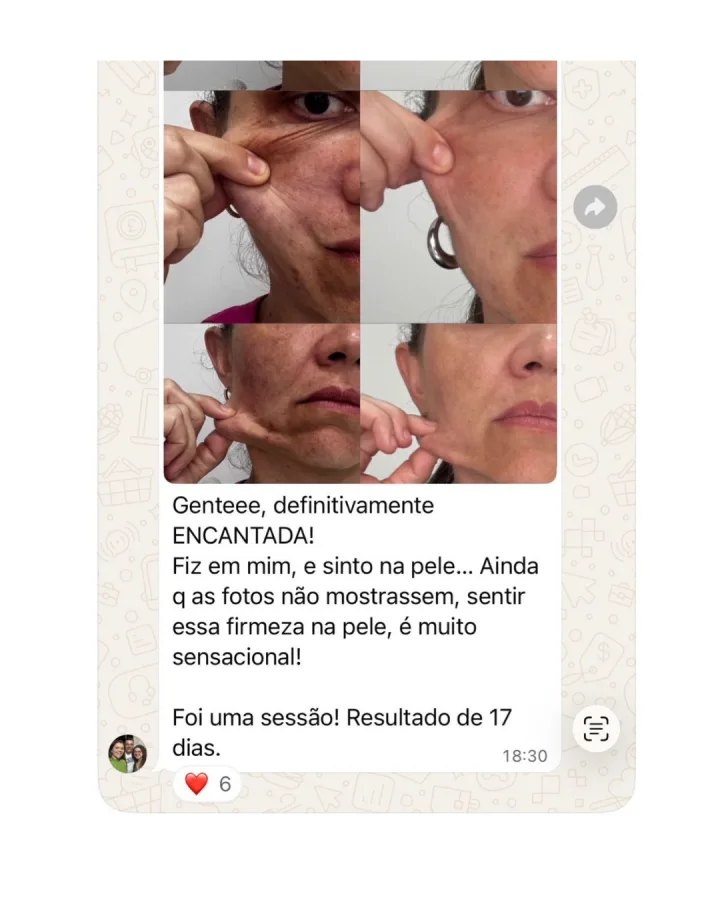 Depoimento de paciente
